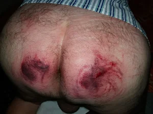 Výprasky a ballbusting