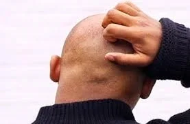 HLADAM SEXUALNU OTROKYNU